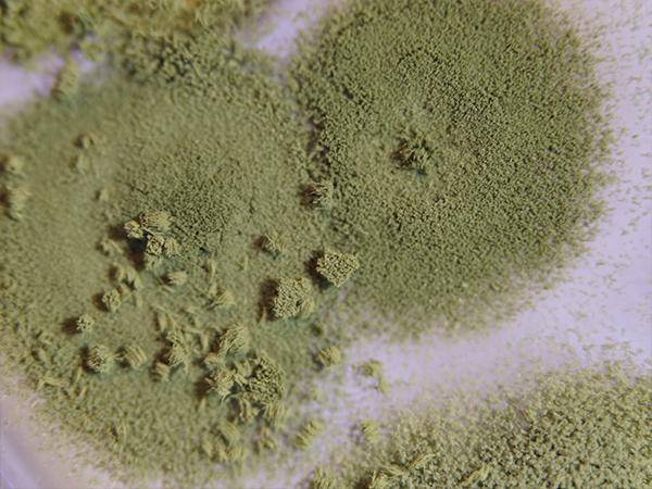 Schimmelpilzkolonien auf einem Nährmedium